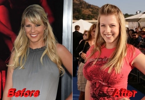 A picture of Jodie Sweetin before (left) and after (right) breast implants.
